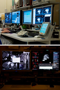 3D医用影像学处理工作站 「Ziostation2」